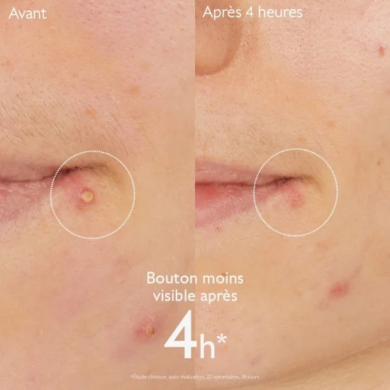 CAUDALIE VINOPURE - STOP BOUTONS SALICYLIQUE 15ML