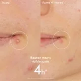 CAUDALIE VINOPURE - STOP BOUTONS SALICYLIQUE 15ML