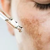 Anti-taches et dépigmentants